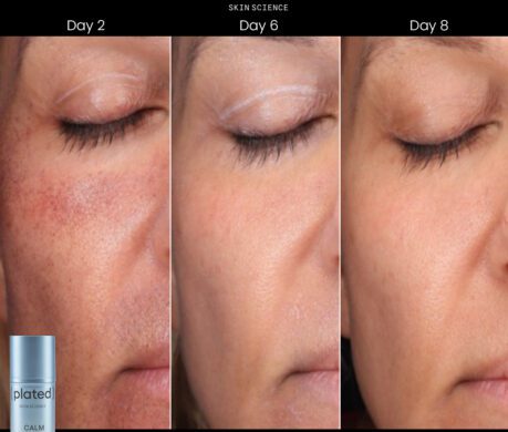 CALM Serum_Before After 1 459x390