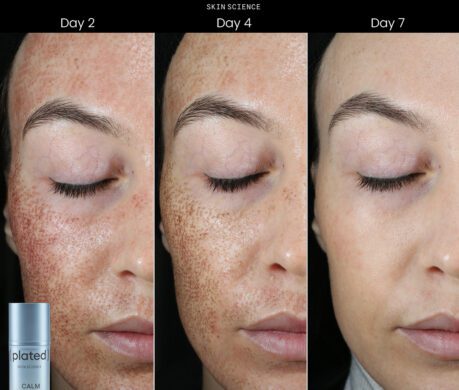 CALM Serum_Before After 459x390