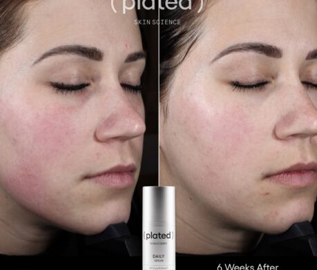 DAILY_Before After 459x390