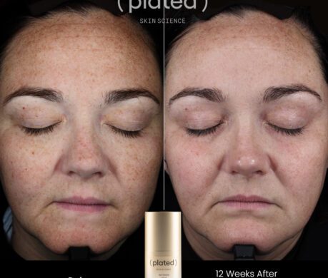 INTENSE_Before After 1 459x390