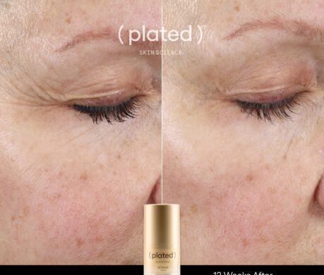 INTENSE_Before After_Around Eye 459x390