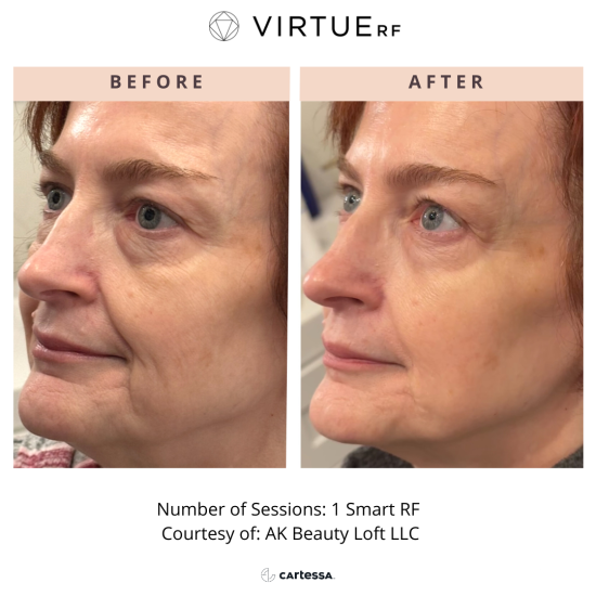 AKBeautyVirtue174118522190 (1)