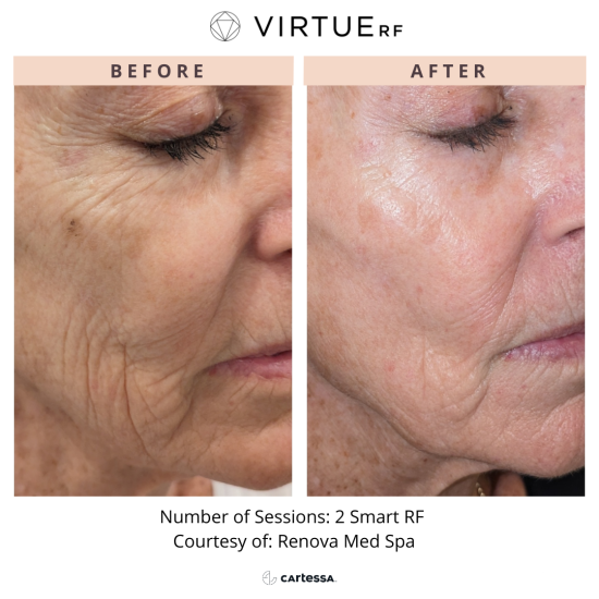 RenovaMedSpa174118544283